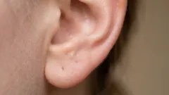 Proč máme v uších tolik ušního mazu: pravda, o které se nemluví